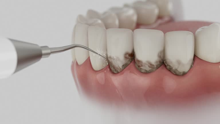Reliable Emergency Dentist contractor in Glencoe, FL by Smile Center Dentistry